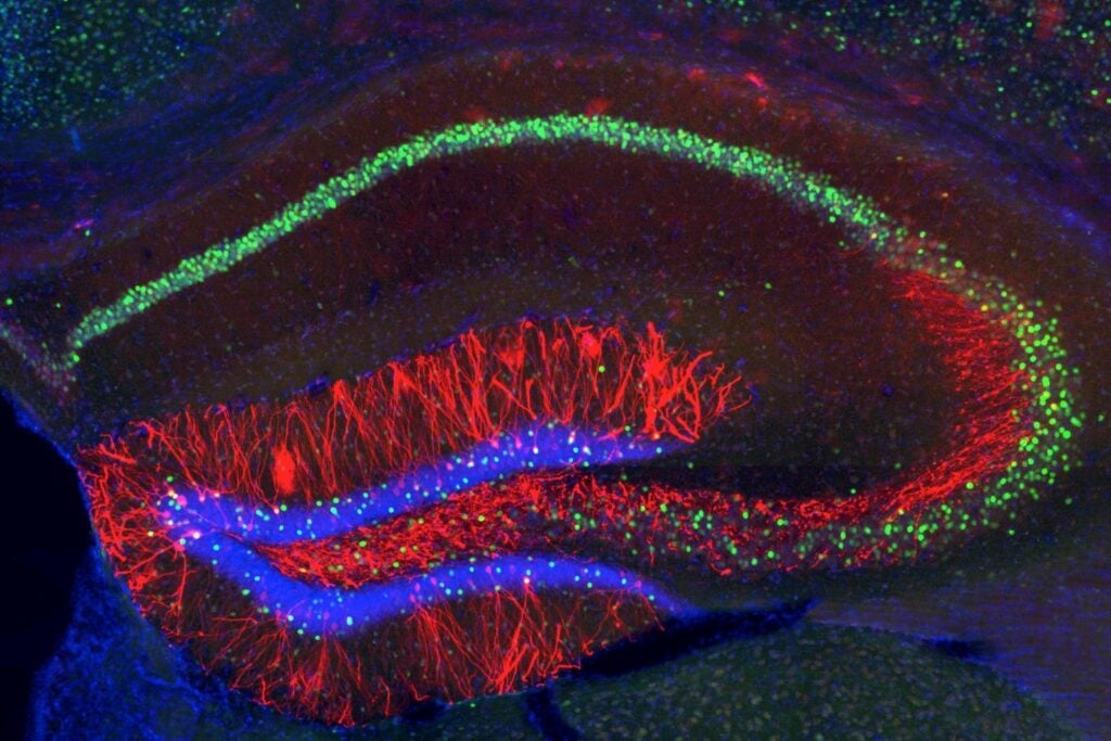 El cerebro tiene un dilema cada vez que recuerda: cambiar el recuerdo o protegerlo. Un experimento acaba de encontrar la pieza que inclina la balanza