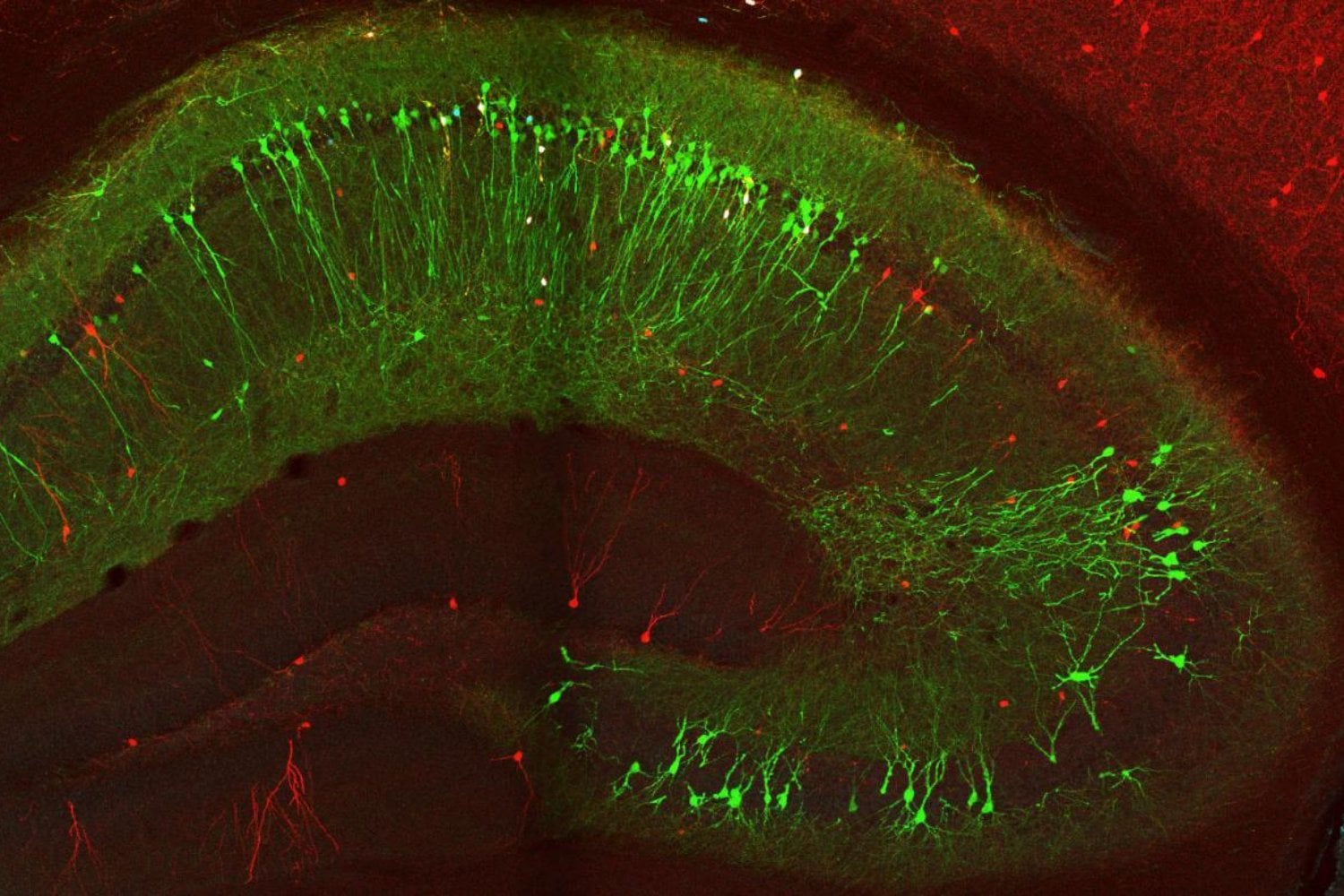 El cerebro tiene un dilema cada vez que recuerda: cambiar el recuerdo o protegerlo. Un experimento acaba de encontrar la pieza que inclina la balanza