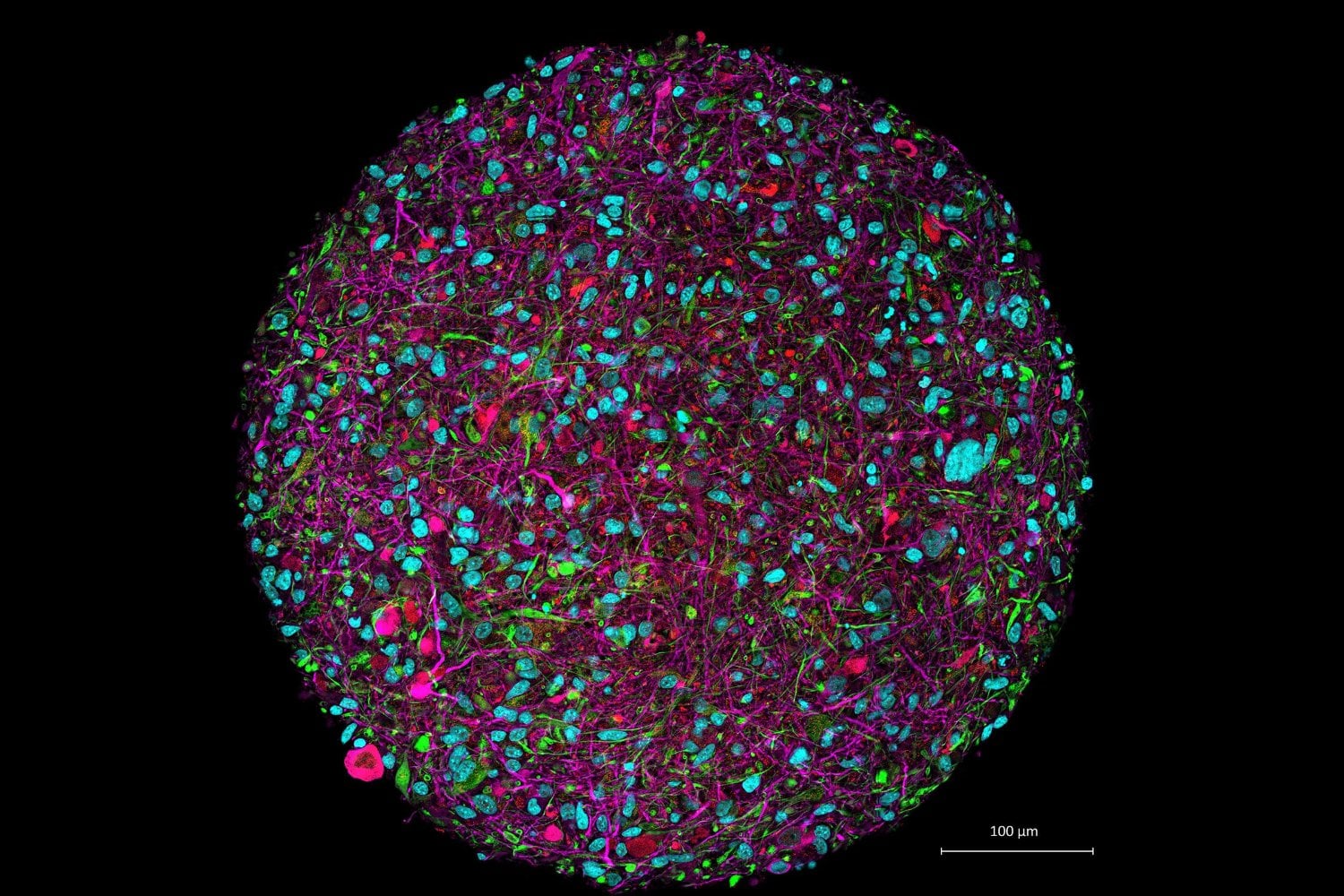 Científicos cultivaron pequeños cerebros humanos en un laboratorio y los conectaron a un sistema capaz de leer braille. El experimento consiguió algo que parecía ciencia ficción