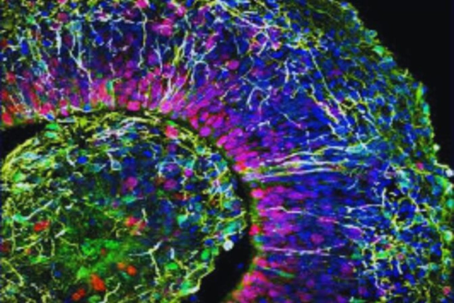 Científicos cultivaron pequeños cerebros humanos en un laboratorio y los conectaron a un sistema capaz de leer braille. El experimento consiguió algo que parecía ciencia ficción