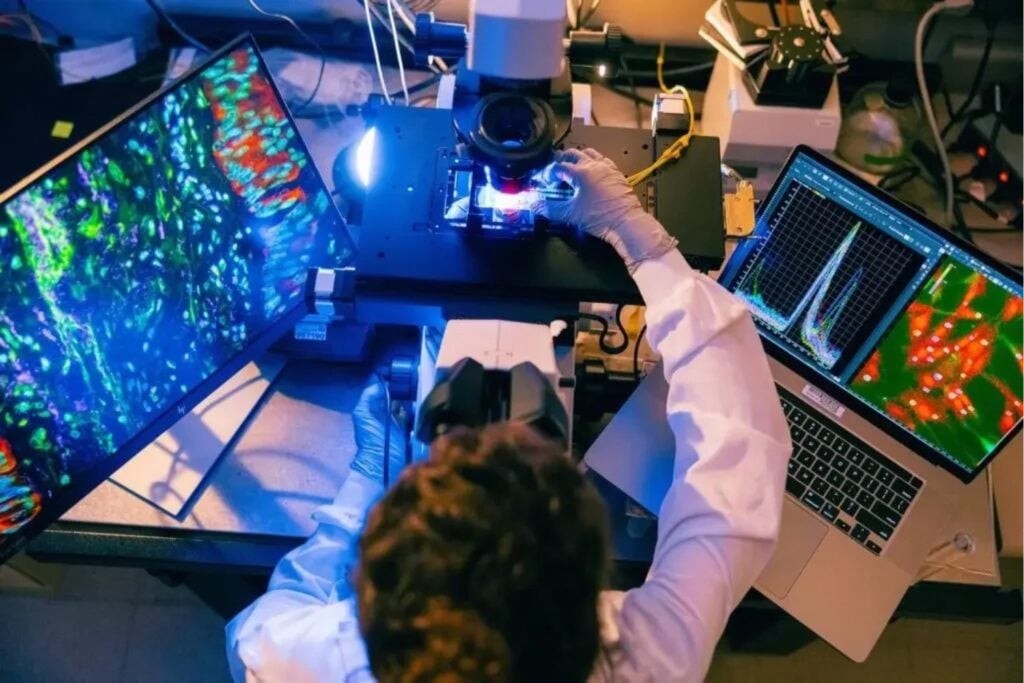 Una vacuna experimental contra el cáncer de páncreas activó las defensas del 98,9 % de los pacientes. El resultado es extraordinario, pero todavía queda una prueba decisiva