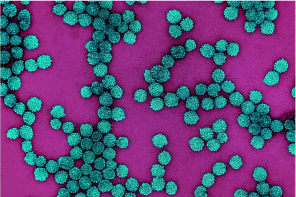 Millones de personas desarrollan cáncer por infecciones que podrían prevenirse. Un nuevo estudio revela que una de cada ocho diagnósticos tiene ese origen