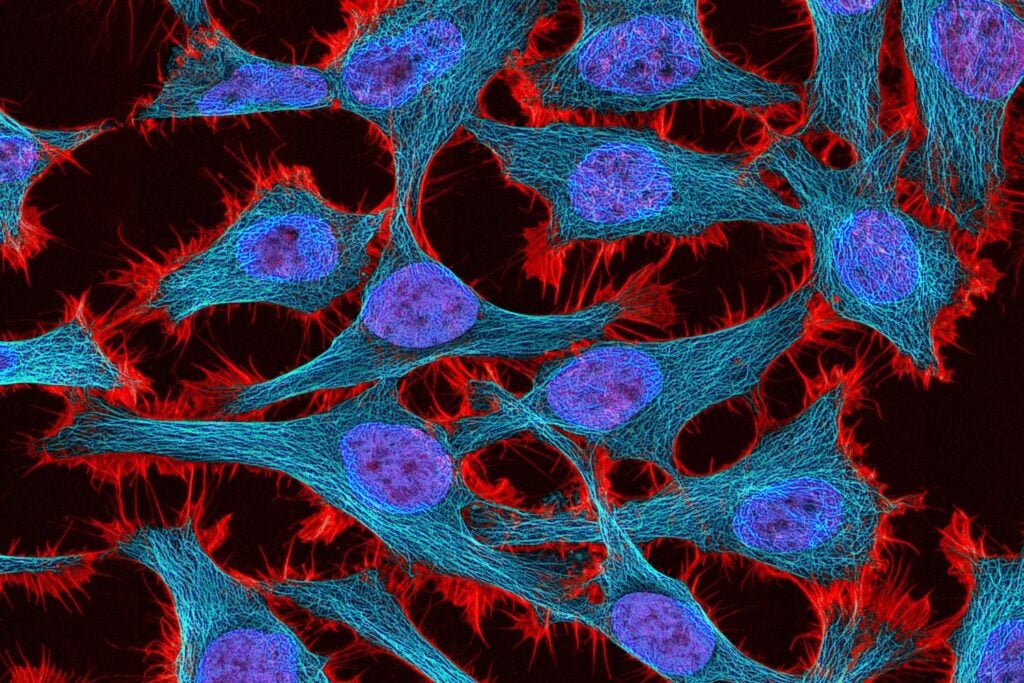 La vida pasó miles de millones de años intentando hacerse más compleja. Una investigación premiada sugiere que todo cambió cuando encontró un límite inesperado