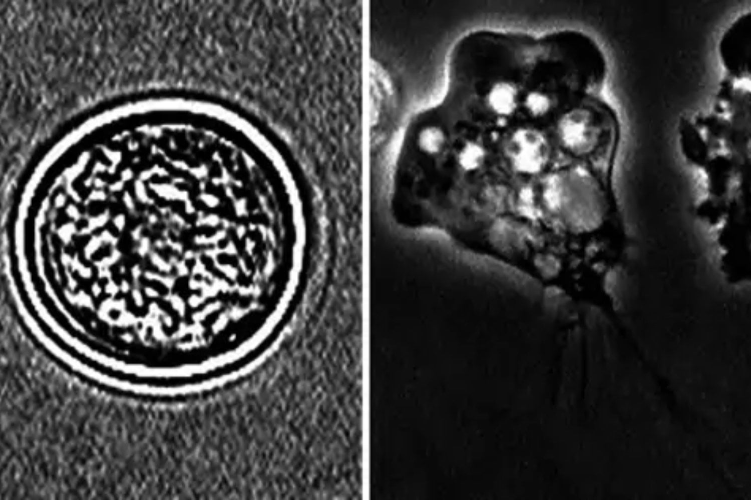 Durante años nadie entendió por qué la “ameba comecerebros” iba directo al cerebro. Un nuevo estudio apunta a una respuesta inquietante