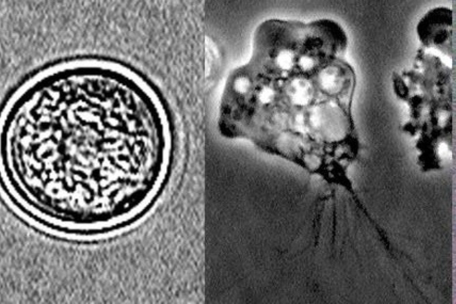 Naegleria Fowleri